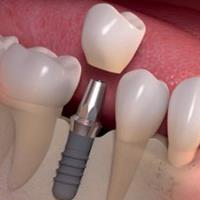 Maylands Dental Centre image 1